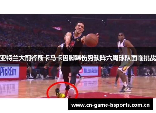 亚特兰大前锋斯卡马卡因脚踝伤势缺阵六周球队面临挑战